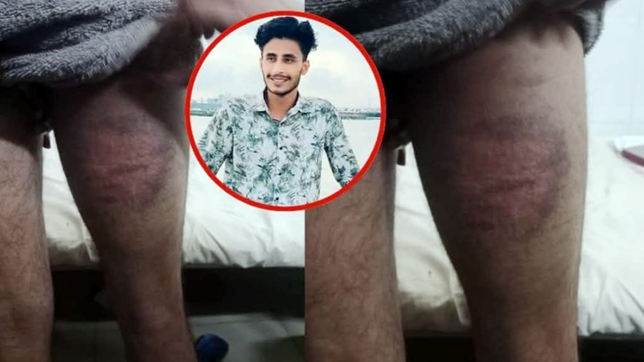থানায় নিয়ে ছাত্রদল নেতাকে মারধর