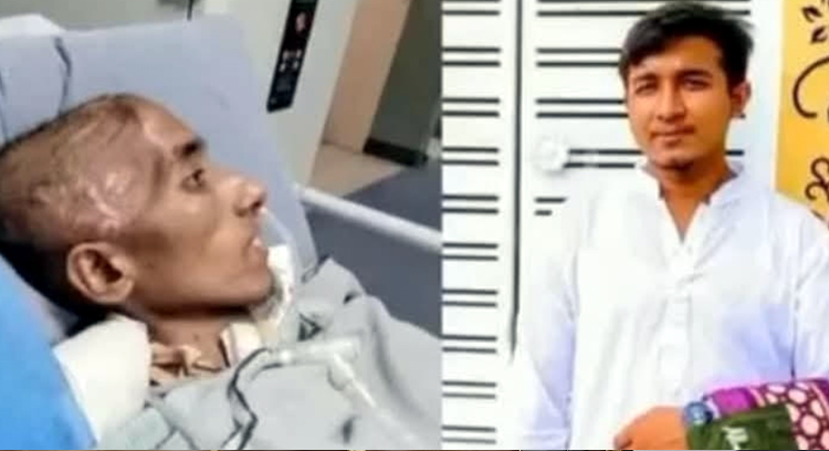 জুলাই আন্দোলনে আহত লক্ষ্মীপুরের হাসানের মৃত্যু, দাফন হবে নোয়াখালীতে