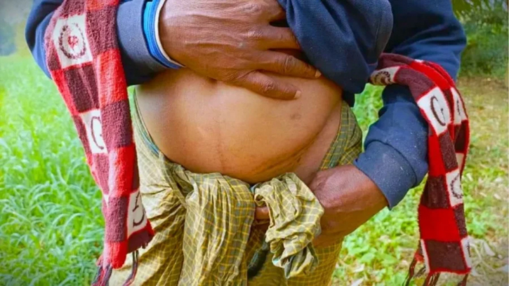 আল জাজিরা প্রতিবেদন: কিডনি বিক্রির গ্রামে দারিদ্র্যের করুণ চিত্র
