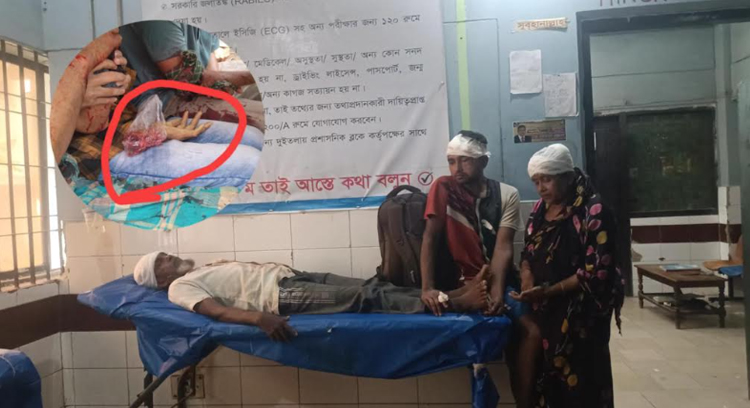 বিজয়নগরে দু পক্ষের সংঘর্ষে ছেলের কোপে বাবার হাত বিচ্ছিন্ন!