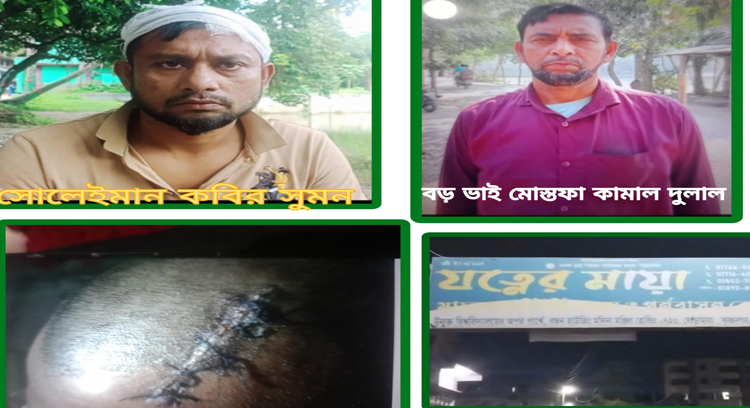 লালামাই ভাবক-পাড়ায় ভাইয়ের হাতে ভাই নিগৃহীত: পুলিশের ভূমিকা নিয়ে প্রশ্ন